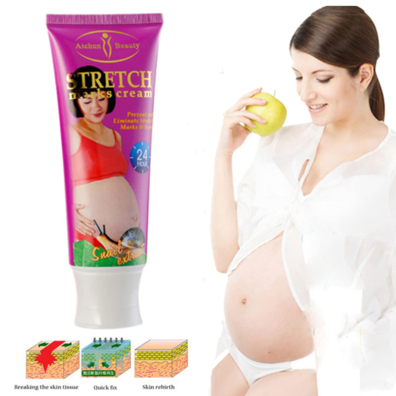 Aichun Beauty Snail Stretch Marks Cream for Pregnancy.